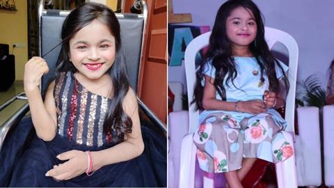 19χρονη με σπάνιο σύνδρομο μοιάζει με... μικρό παιδάκι!